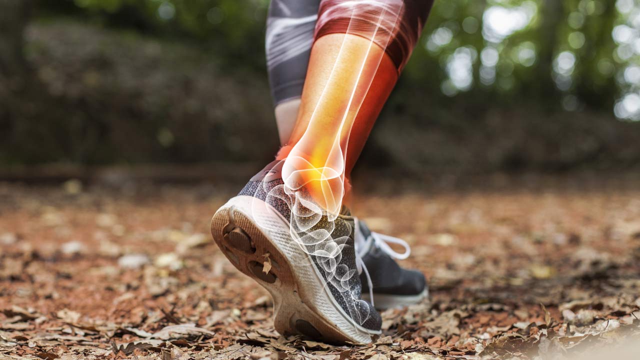 person walking with xray on ankle joint